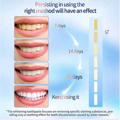 WhiteningToothpaste 1+1 GRATIS: Niacinamid-Tandpasta Til Blegning Og Fjernelse Af Pletter
