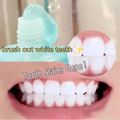 WhiteningToothpaste 1+1 GRATIS: Niacinamid-Tandpasta Til Blegning Og Fjernelse Af Pletter